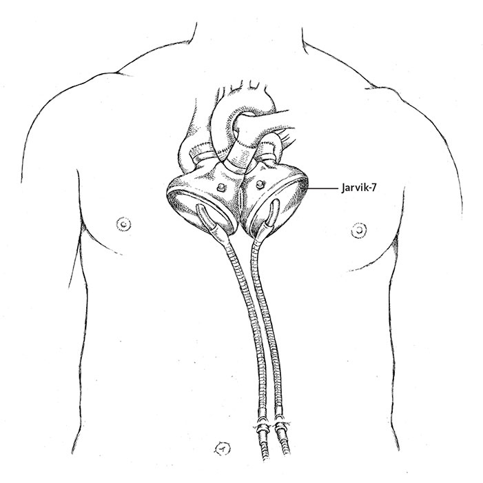 Иллюстрация к книге — Пламенный насос. Естественная история сердца [i_038.jpg]