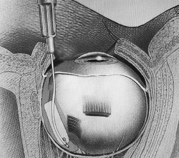 Иллюстрация к книге — Во все глаза. Секретная книга для тех, кто хочет сохранить или исправить зрение [i_008.jpg]