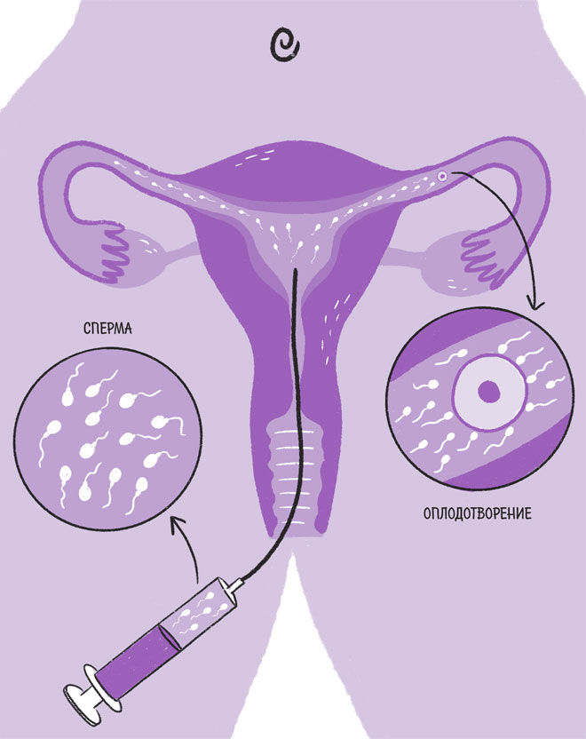 Иллюстрация к книге — Эндометриоз. Как разобраться в причинах и симптомах и позаботиться о себе в повседневной жизни [i_014.jpg]