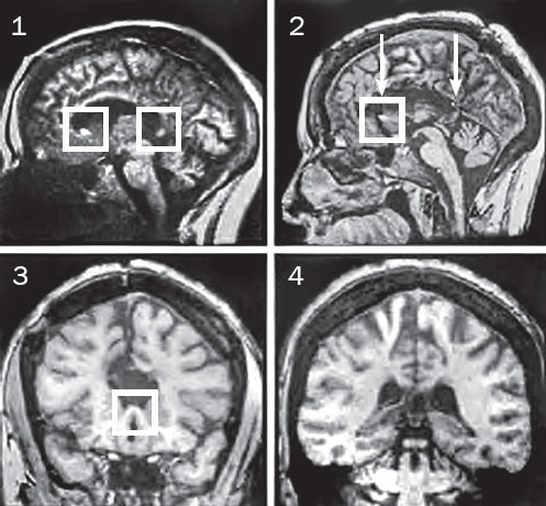 Иллюстрация к книге — Истории от разных полушарий мозга. Жизнь в нейронауке [i_008.jpg]