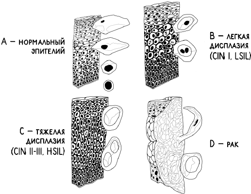 Иллюстрация к книге — В зоне риска. Тонкости защиты женского организма. Как ВПЧ проникает в наш организм, чем он опасен и что поможет избежать последствий [i_032.jpg]
