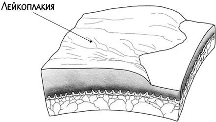Иллюстрация к книге — В зоне риска. Тонкости защиты женского организма. Как ВПЧ проникает в наш организм, чем он опасен и что поможет избежать последствий [i_040.jpg]