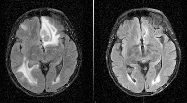 Иллюстрация к книге — Потерявшая разум. Откровенная история нейроученого о болезни, надежде и возвращении [i_009.jpg]