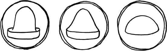 Иллюстрация к книге — 1000 вопросов и ответов по гинекологии [_35.jpg]