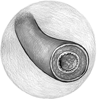 Иллюстрация к книге — Хрупкий мозг. Инсульту не быть? [img_26.jpg]