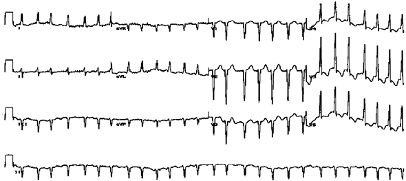 Иллюстрация к книге — Хрупкий мозг. Инсульту не быть? [img_39.jpg]