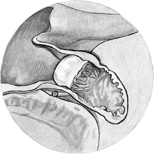 Иллюстрация к книге — Хрупкий мозг. Инсульту не быть? [img_43.jpg]