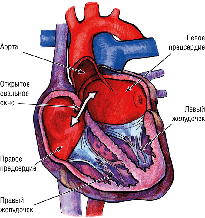 Иллюстрация к книге — Хрупкий мозг. Инсульту не быть? [img_44.jpg]