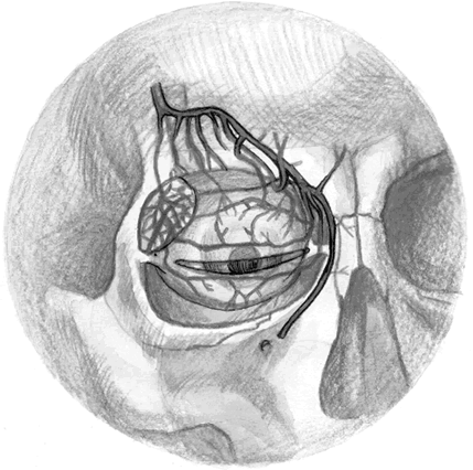 Иллюстрация к книге — Хрупкий мозг. Инсульту не быть? [img_50.jpg]