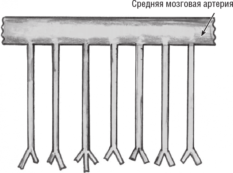Иллюстрация к книге — Хрупкий мозг. Инсульту не быть? [img_58.jpg]