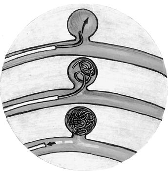 Иллюстрация к книге — Хрупкий мозг. Инсульту не быть? [img_75.jpg]