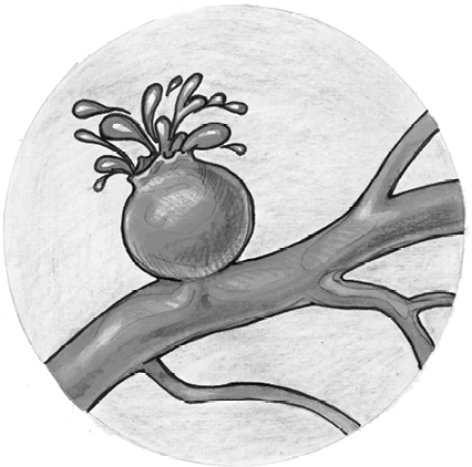 Иллюстрация к книге — Хрупкий мозг. Инсульту не быть? [img_76.jpg]