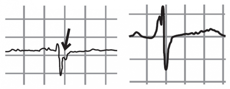 Иллюстрация к книге — Сердце спортсмена. Актуальные проблемы спортивной кардиологии [i_011.jpg]