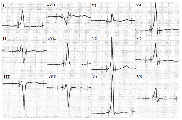 Иллюстрация к книге — Сердце спортсмена. Актуальные проблемы спортивной кардиологии [i_021.jpg]