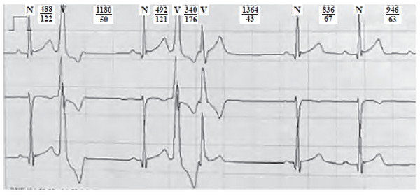 Иллюстрация к книге — Сердце спортсмена. Актуальные проблемы спортивной кардиологии [i_035.jpg]