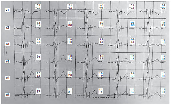 Иллюстрация к книге — Сердце спортсмена. Актуальные проблемы спортивной кардиологии [i_039.jpg]