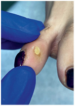 Иллюстрация к книге — Подология понятно. Важен каждый шаг. Справочник по проблемам подологии для клиентов и мастеров эстетики [i_018.jpg]