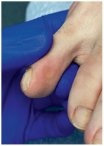 Иллюстрация к книге — Подология понятно. Важен каждый шаг. Справочник по проблемам подологии для клиентов и мастеров эстетики [i_020.jpg]