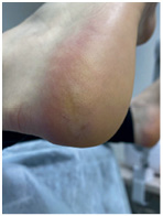 Иллюстрация к книге — Подология понятно. Важен каждый шаг. Справочник по проблемам подологии для клиентов и мастеров эстетики [i_033.jpg]