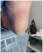 Иллюстрация к книге — Подология понятно. Важен каждый шаг. Справочник по проблемам подологии для клиентов и мастеров эстетики [i_034.jpg]