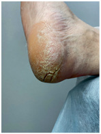 Иллюстрация к книге — Подология понятно. Важен каждый шаг. Справочник по проблемам подологии для клиентов и мастеров эстетики [i_037.jpg]