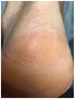 Иллюстрация к книге — Подология понятно. Важен каждый шаг. Справочник по проблемам подологии для клиентов и мастеров эстетики [i_041.jpg]