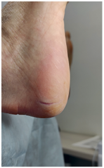 Иллюстрация к книге — Подология понятно. Важен каждый шаг. Справочник по проблемам подологии для клиентов и мастеров эстетики [i_043.jpg]