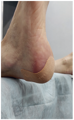 Иллюстрация к книге — Подология понятно. Важен каждый шаг. Справочник по проблемам подологии для клиентов и мастеров эстетики [i_044.jpg]