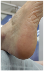 Иллюстрация к книге — Подология понятно. Важен каждый шаг. Справочник по проблемам подологии для клиентов и мастеров эстетики [i_045.jpg]