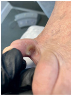 Иллюстрация к книге — Подология понятно. Важен каждый шаг. Справочник по проблемам подологии для клиентов и мастеров эстетики [i_055.jpg]