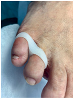 Иллюстрация к книге — Подология понятно. Важен каждый шаг. Справочник по проблемам подологии для клиентов и мастеров эстетики [i_057.jpg]