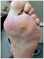 Иллюстрация к книге — Подология понятно. Важен каждый шаг. Справочник по проблемам подологии для клиентов и мастеров эстетики [i_063.jpg]