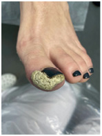 Иллюстрация к книге — Подология понятно. Важен каждый шаг. Справочник по проблемам подологии для клиентов и мастеров эстетики [i_074.jpg]