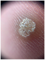 Иллюстрация к книге — Подология понятно. Важен каждый шаг. Справочник по проблемам подологии для клиентов и мастеров эстетики [i_077.jpg]