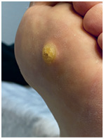 Иллюстрация к книге — Подология понятно. Важен каждый шаг. Справочник по проблемам подологии для клиентов и мастеров эстетики [i_078.jpg]