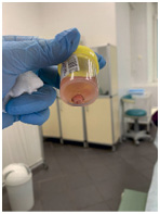 Иллюстрация к книге — Подология понятно. Важен каждый шаг. Справочник по проблемам подологии для клиентов и мастеров эстетики [i_080.jpg]