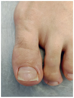 Иллюстрация к книге — Подология понятно. Важен каждый шаг. Справочник по проблемам подологии для клиентов и мастеров эстетики [i_084.jpg]