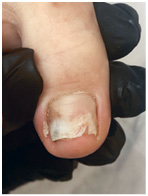 Иллюстрация к книге — Подология понятно. Важен каждый шаг. Справочник по проблемам подологии для клиентов и мастеров эстетики [i_085.jpg]