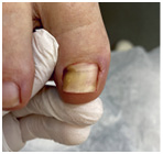 Иллюстрация к книге — Подология понятно. Важен каждый шаг. Справочник по проблемам подологии для клиентов и мастеров эстетики [i_095.jpg]