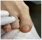 Иллюстрация к книге — Подология понятно. Важен каждый шаг. Справочник по проблемам подологии для клиентов и мастеров эстетики [i_097.jpg]