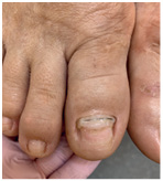 Иллюстрация к книге — Подология понятно. Важен каждый шаг. Справочник по проблемам подологии для клиентов и мастеров эстетики [i_099.jpg]