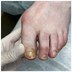 Иллюстрация к книге — Подология понятно. Важен каждый шаг. Справочник по проблемам подологии для клиентов и мастеров эстетики [i_103.jpg]