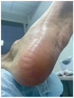 Иллюстрация к книге — Подология понятно. Важен каждый шаг. Справочник по проблемам подологии для клиентов и мастеров эстетики [i_107.jpg]