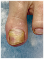 Иллюстрация к книге — Подология понятно. Важен каждый шаг. Справочник по проблемам подологии для клиентов и мастеров эстетики [i_110.jpg]