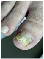 Иллюстрация к книге — Подология понятно. Важен каждый шаг. Справочник по проблемам подологии для клиентов и мастеров эстетики [i_116.jpg]