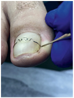 Иллюстрация к книге — Подология понятно. Важен каждый шаг. Справочник по проблемам подологии для клиентов и мастеров эстетики [i_118.jpg]