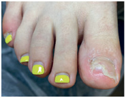 Иллюстрация к книге — Подология понятно. Важен каждый шаг. Справочник по проблемам подологии для клиентов и мастеров эстетики [i_126.jpg]