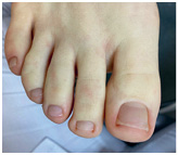 Иллюстрация к книге — Подология понятно. Важен каждый шаг. Справочник по проблемам подологии для клиентов и мастеров эстетики [i_130.jpg]