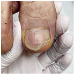 Иллюстрация к книге — Подология понятно. Важен каждый шаг. Справочник по проблемам подологии для клиентов и мастеров эстетики [i_133.jpg]