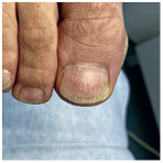 Иллюстрация к книге — Подология понятно. Важен каждый шаг. Справочник по проблемам подологии для клиентов и мастеров эстетики [i_134.jpg]